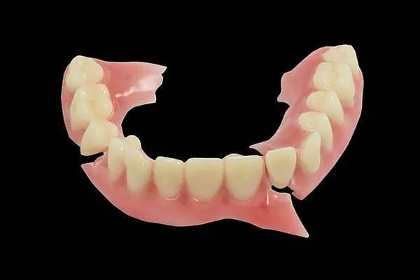A cracked full denture with a broken section, the kind of damage same-day repairs fix